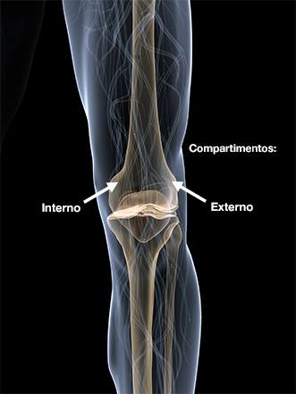 Dr. Marcelo Tostes Dr. Marcelo Tostes: Cirurgia - Osteotomia