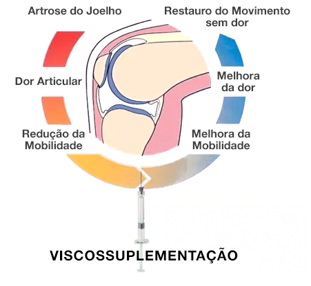 Dr. Marcelo Tostes Dr. Marcelo Tostes: Viscossuplementação / Ácido Hialurônico