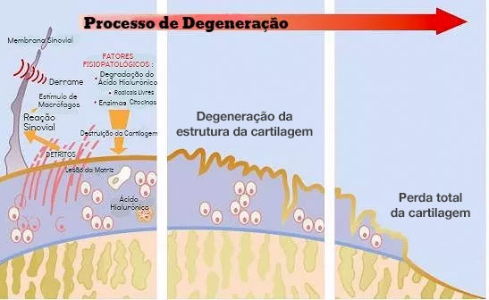 Dr. Marcelo Tostes Dr. Marcelo Tostes: Viscossuplementação / Ácido Hialurônico