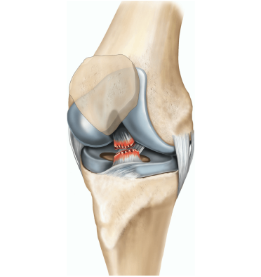 Dr. Marcelo Tostes Ligamentos do Joelho